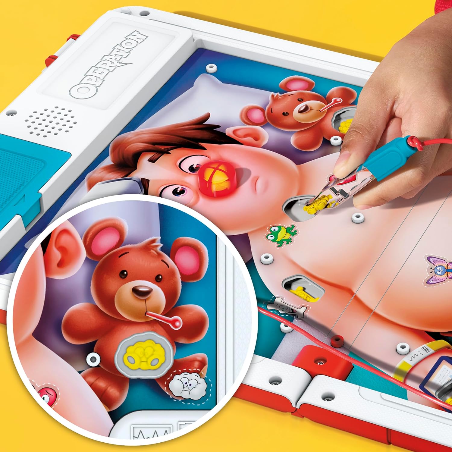 Hasbro Operation | Game in Play